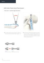 Orthopedic - ARIX Ankle System - Fibula Hook Plate - 6