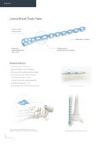 Orthopedic - ARIX Ankle System Lateral Distal Fibula Plate - 4