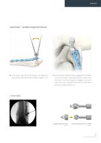 Orthopedic - ARIX Ankle System Lateral Distal Fibula Plate - 7