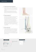 Orthopedic - ARIX Ankle System Lateral Distal Fibula Plate - 8