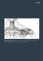 Orthopedic - ARIX Clavicle System - 3