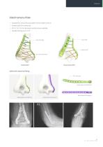 Orthopedic - ARIX Elbow - 7