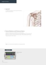 Orthopedic - ARIX Humerus System - 8