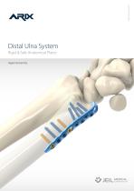 Orthopedic - ARIX Wrist System Distal Ulna - 1