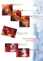 Dental Microscopes - general info-3