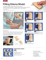 Pitting Edema Model