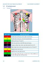 Electrode placement-10
