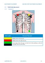 Electrode placement-11