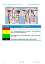 Electrode placement-12