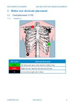 Electrode placement-3