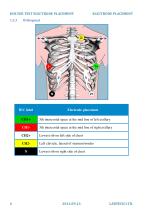 Electrode placement-6