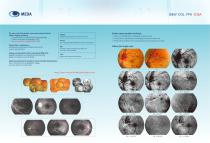 MEDA/Fundus Camera/MD-860-2