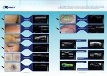 MEDA/skin scanner/MD-310S - 2