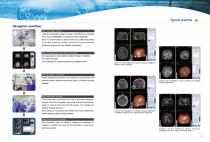 Heal Force Neurosurgery Navigation System Excelim-04 Brochure - 5
