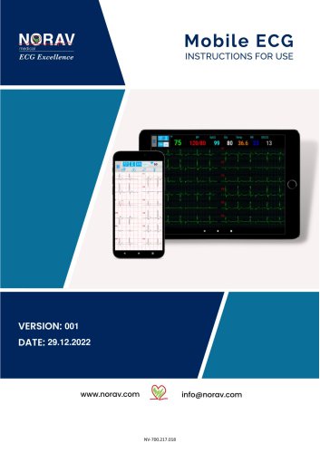 Mobile ECG