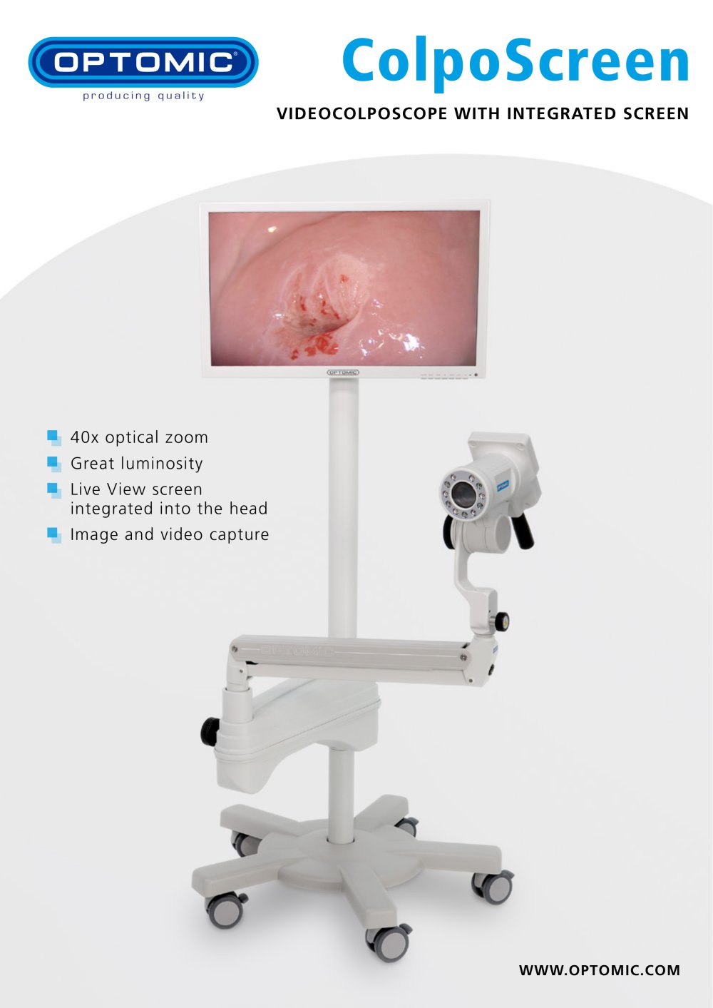 ColpoScreen Videocolposcope - OPTOMIC