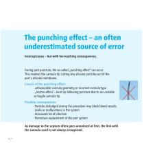 RISK FREE PORT PUNCTURE-6