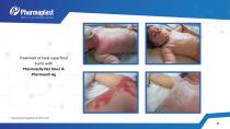 EXPERIENCE OF USING SILVER &IODINE CONTAINING WOUND - 9