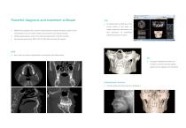 DENTOM CBCT - 6