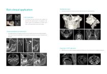 DENTOM CBCT - 7