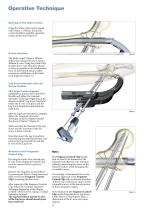 Gamma3 Fragment Control Clip - 4