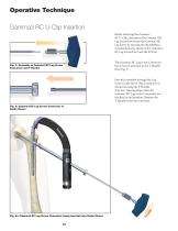 Gamma3 U-Blade Lag Screw - 10