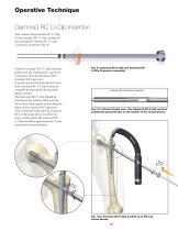 Gamma3 U-Blade Lag Screw - 11