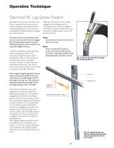 Gamma3 U-Blade Lag Screw - 9