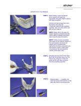 Hoffmann ®  II Compact™   External Fixation System   For Use in Maxillofacial Surgery - 4