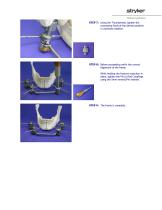 Hoffmann ®  II Compact™   External Fixation System   For Use in Maxillofacial Surgery - 6