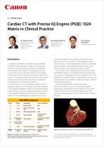 https://eu.medical.canon/products/computed-tomography/piqe/-1