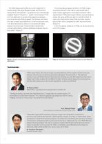https://eu.medical.canon/products/computed-tomography/piqe/-2
