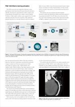 https://eu.medical.canon/products/computed-tomography/piqe/-3