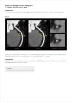 https://eu.medical.canon/products/computed-tomography/piqe/-4
