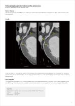 https://eu.medical.canon/products/computed-tomography/piqe/-5