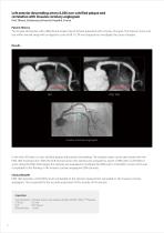 https://eu.medical.canon/products/computed-tomography/piqe/-6