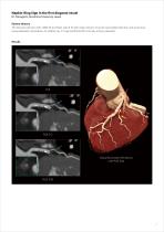 https://eu.medical.canon/products/computed-tomography/piqe/-7