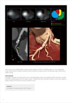 https://eu.medical.canon/products/computed-tomography/piqe/-8