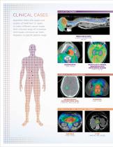 Radiotherapy and Radiosurgery with RapidArc - 12