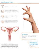 Paragard intrauterine copper contraceptive - 3