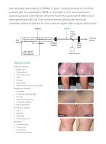 Aesthetic laser systems - 7