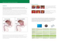 Medical lasers for BPH surgery, Urology - 2