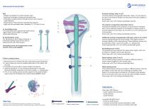 Humeral intramedullary nail Advanced Humeral Nail-2