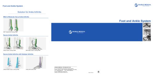 Total Foot and Ankle System