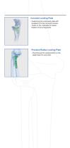 Trauma Plates Solutions for Elbow-4