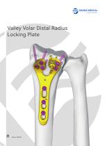 Valley Volar Distal Radius Locking Plate-1