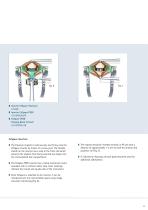 Aesculap® CeSpace® Titanium / PEEK - 11