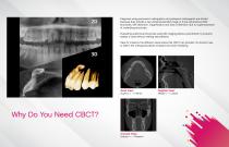 W3  of CBCT The Why, When and Which of 3D Imagin-2