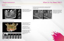 W3  of CBCT The Why, When and Which of 3D Imagin-4