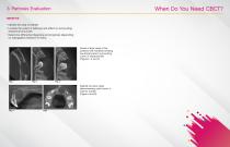 W3  of CBCT The Why, When and Which of 3D Imagin-6